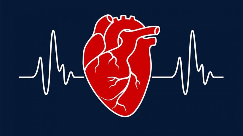 Afecţiunile cardiovasculare. Arteriopatia periferică: o problemă serioasă de sănătate publică. Cum se tratează