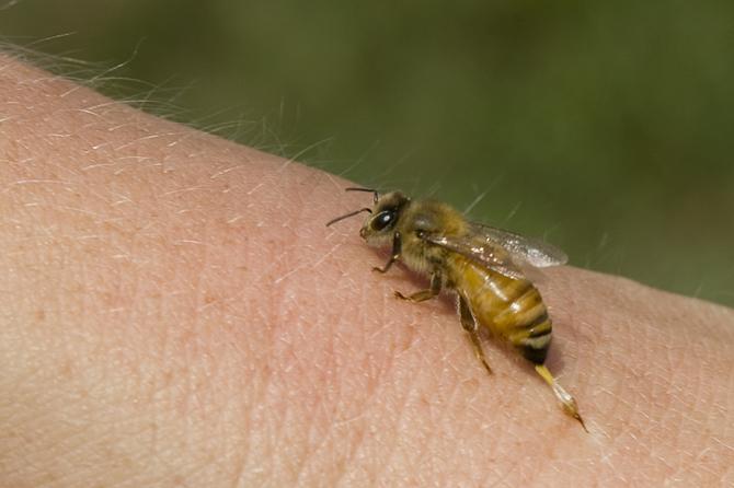 Incredibil! Un bărbat a murit după ce a fost înţepat de o viespe