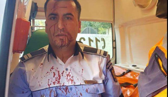 Craiova - Bărbatul care a snopit în bătaie un polițist a fost reținut