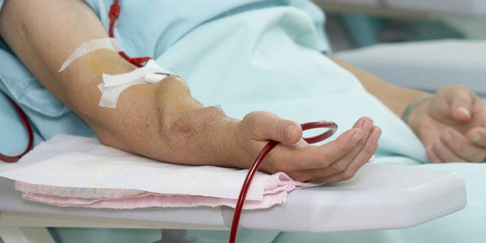 Hemodializa şi fistula arteriovenoasă - tot ce trebuie să știi