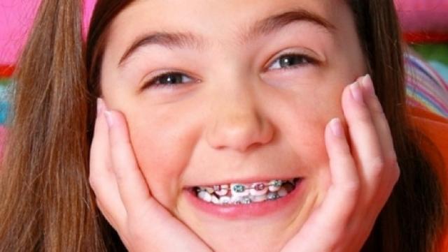Vouchere de până la 990 de lei pentru aparate ortodontice fixe destinate copiilor