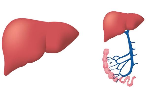 Ciroza hepatică – semnele care ar trebui să vă trimită la medic
