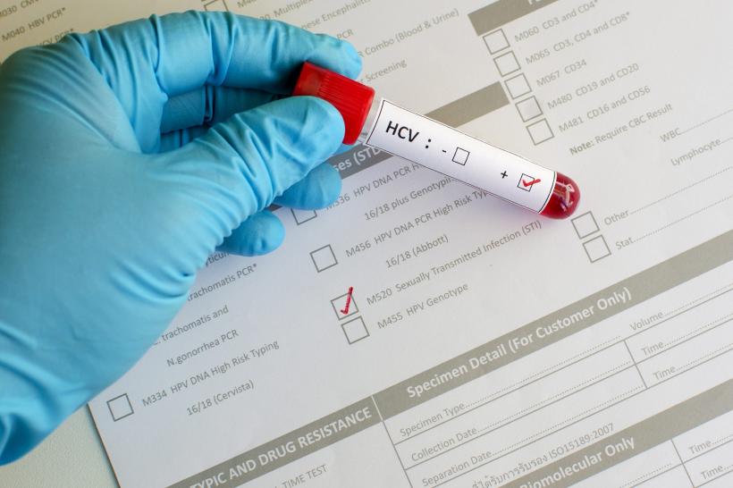 Un american, acuzat de divulgarea de informații confidențiale despre mii de purtători ai virusului HIV
