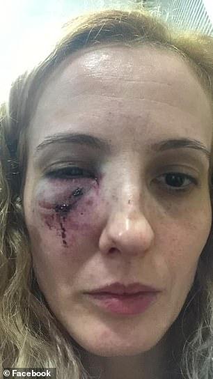 O mamă româncă din Anglia, bătută crunt de 10 adolescenţi chiar în faţa casei 