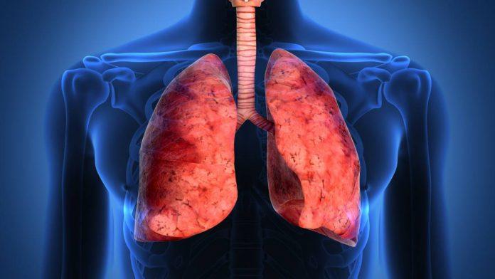 Tratament revoluționar împotriva cancerului pulmonar, în afara listei de medicamente esențiale