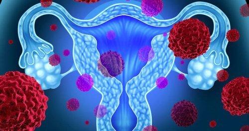 Sindromul de șoc toxic menstrual stafilococic