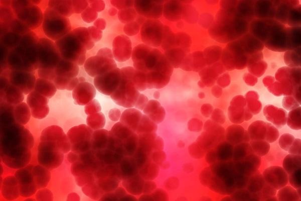 Anemia hemolitică – cauze, diagnostic, tratament