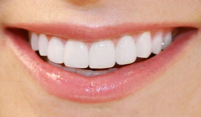 9 sfaturi pentru albirea dinților