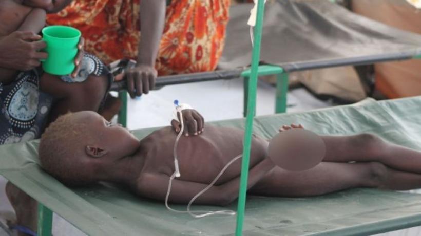 Ultimul focar de holeră din Etiopia a provocat moartea a zeci de persoane