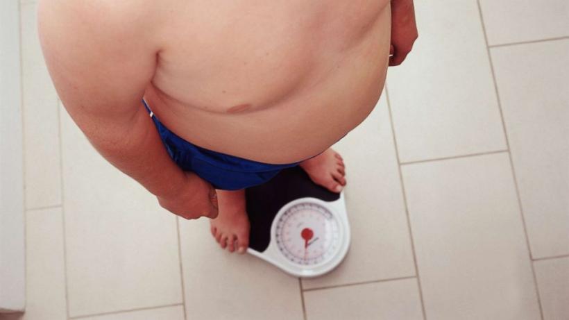 500.000 de copii români obezi, până în 2030
