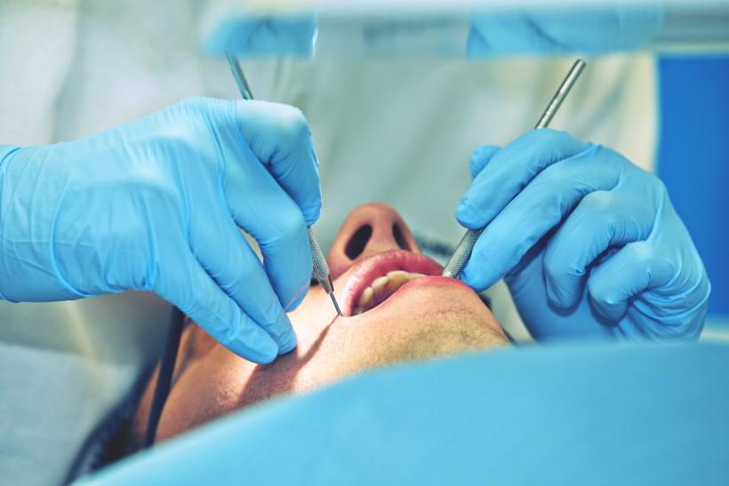 Detartraj, sigilări dentare, fluorizare și alte metode de profilaxie dentară