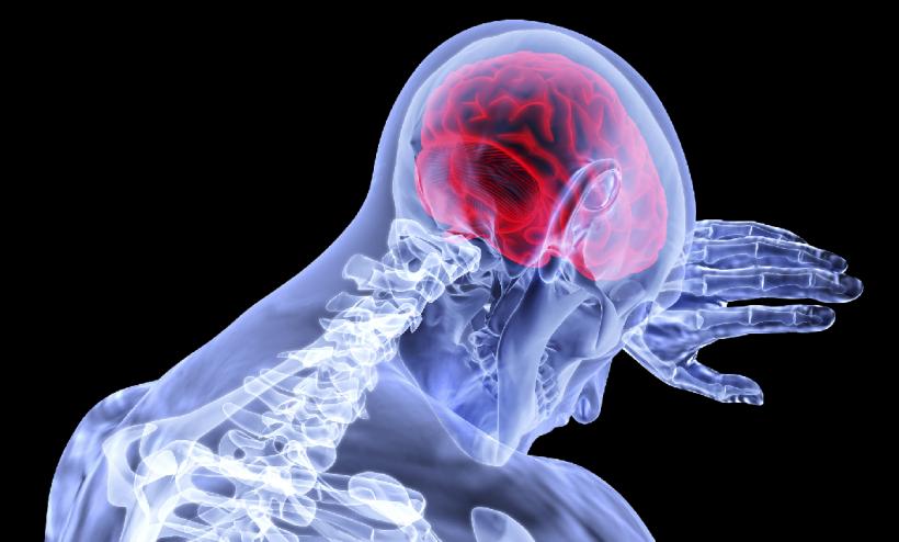 Accidentele vasculare cerebrale trecătoare anunţă un AVC masiv în creier