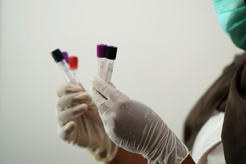 Testul de sânge care poate depista mai mult de 50 de tipuri de cancer