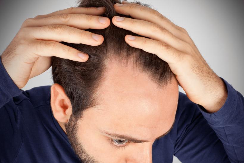 Căderea părului din cauza stresului, afecțiunea secolului 21