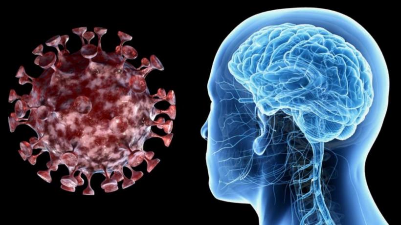 Creierul este afectat după COVID-19, ca după chimioterapie