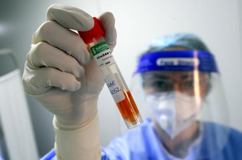 Variantă periculoasă de HIV, descoperită în Olanda