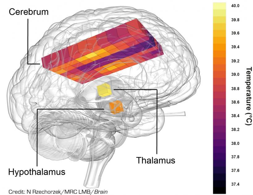 Creierul uman, mai „încins” decât se credea anterior: poate depăși 40°C în timpul zilei