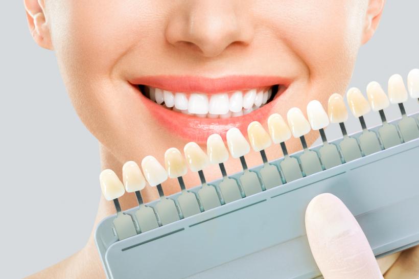 7 sfaturi pentru a păstra dantura albă fără a afecta smalțul dentar