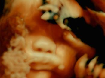 Festivalul Internațional de Film Experimental București: Handle with care 18797820