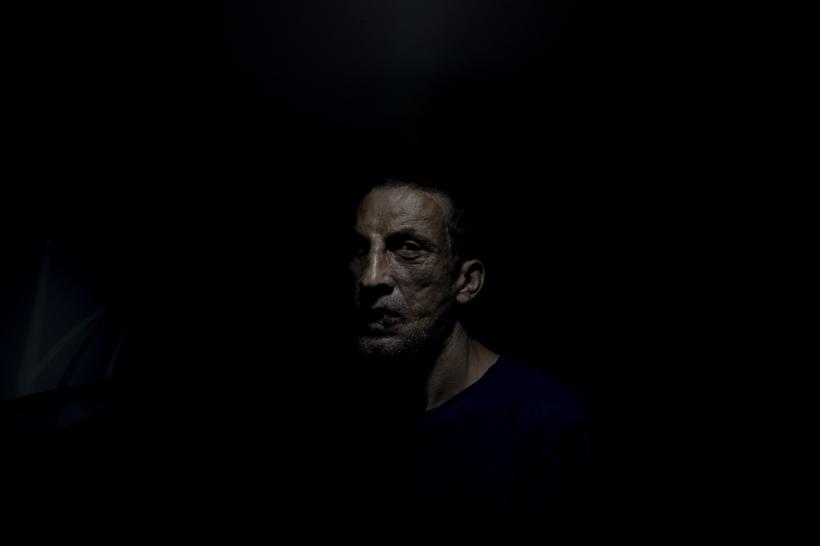 Prima persoană care a făcut un transplant de față în Turcia, Ugur Acar, surprins într-o ședință foto 18807817