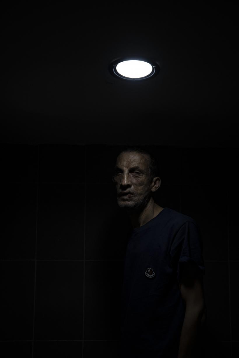 Prima persoană care a făcut un transplant de față în Turcia, Ugur Acar, surprins într-o ședință foto 18807819