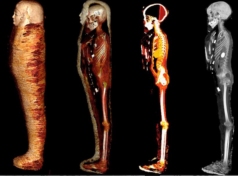 &quot;Băiatul de aur&quot; mumificat, un adolescent mort acum 2.300 de ani în Egipt, acoperit cu 49 de amulete prețioase