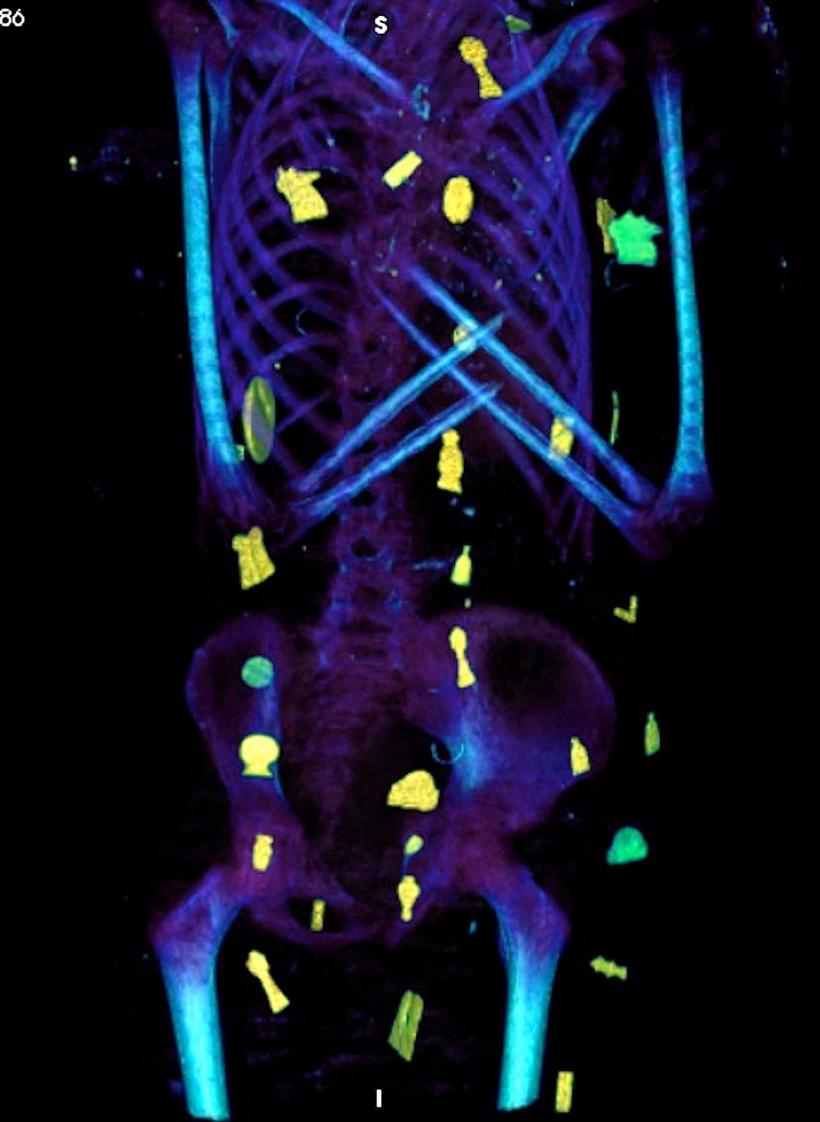 "Băiatul de aur" mumificat, un adolescent mort acum 2.300 de ani în Egipt, acoperit cu 49 de amulete prețioase 18822121