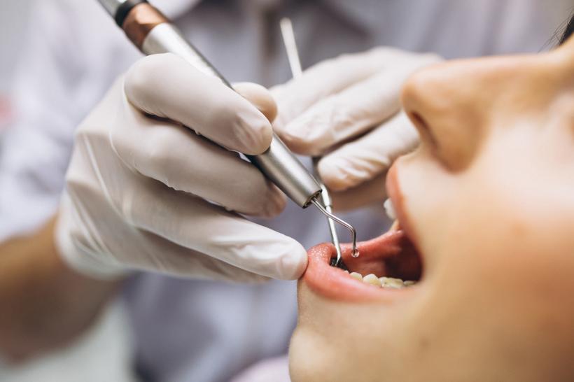 Implanturile dentare: cum funcționează și care sunt avantajele lor