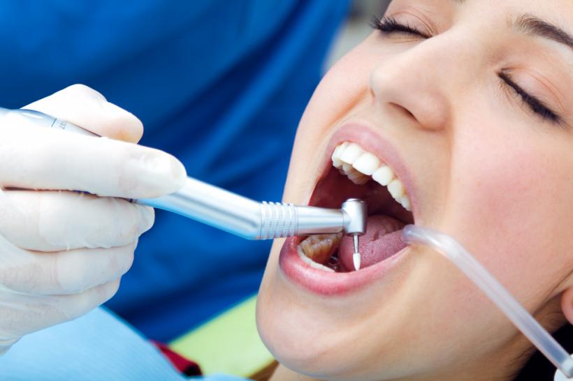 Cum să previi cariile și afecțiunile asociate acestora: 4 sfaturi pentru menținerea dinților sănătoși