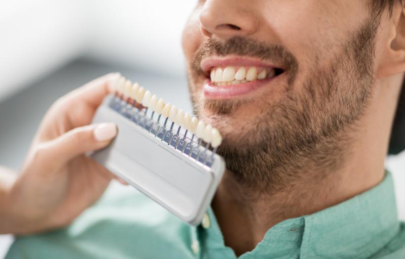Fațete dentare - soluții ideale pentru un zâmbet impecabil