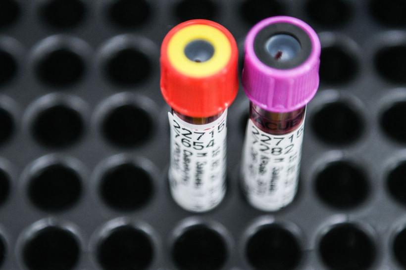 Un test de sânge poate scuti bolnavii cu cancer de chimioterapie