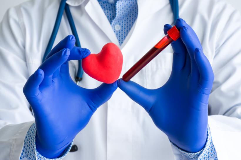 6 analize de sânge pentru evaluarea riscului de boală cardiovasculară