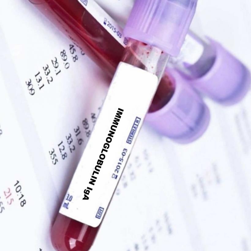 Avertismentul pacienților lăsați fără imunoglobulină: „Situația este gravă”