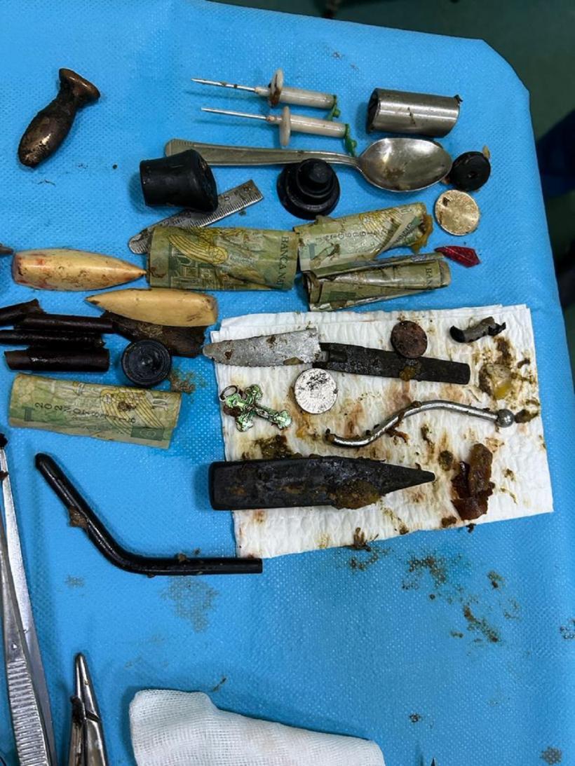 Viața bate filmul: Bani, lamă de cuțit, lingură și alte obiecte de metal, în stomacul unui pacient din Iași