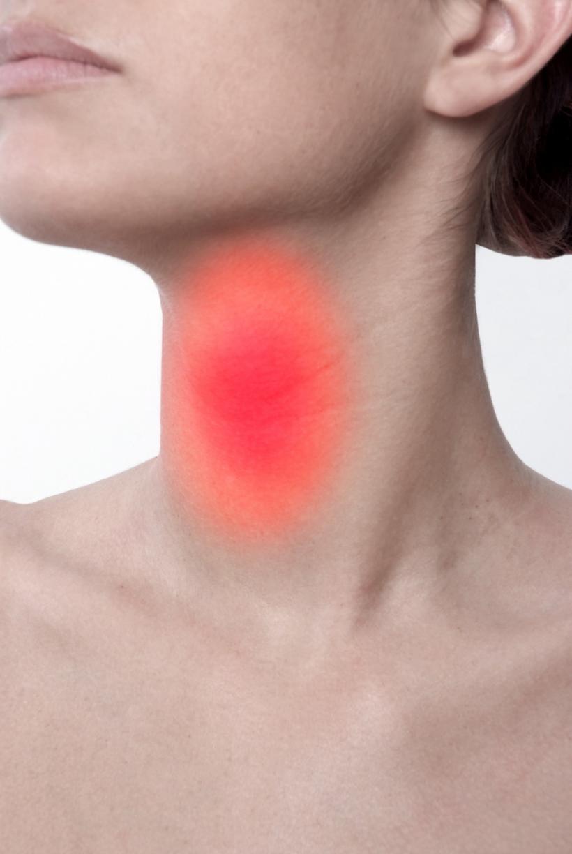 Tot ce trebuie să știi despre roșu în gât, eterna spaimă a românilor: băuturile reci și înghețata ajută la calmarea durerilor 18854200