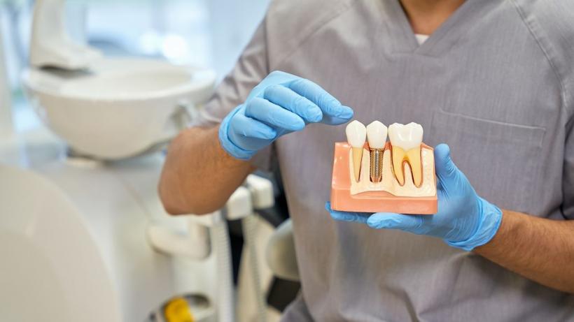 Sfatul medicului dentist: când ar trebui să înlocuiești un dinte lipsă?