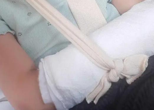 Revoltător! Medicii din Alba i-au recomandat unguent unei fetițe de 5 ani cu mâna ruptă. Cum se apără doctorii?