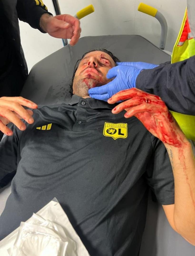 Derbyul olimpic dintre Marseille și Lyon a fost amânat. Autocarul lionez, atacat cu pietre de ultrași. Antrenorul Fabio Grosso a fost rănit 18866976