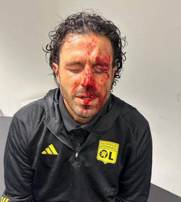 Derbyul olimpic dintre Marseille și Lyon a fost amânat. Autocarul lionez, atacat cu pietre de ultrași. Antrenorul Fabio Grosso a fost rănit 18866978