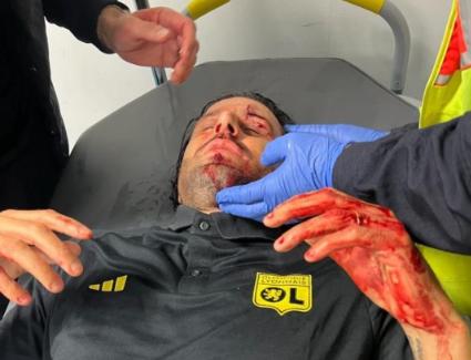 Derbyul olimpic dintre Marseille și Lyon a fost amânat. Autocarul lionez, atacat cu pietre de ultrași. Antrenorul Fabio Grosso a fost rănit 18866979