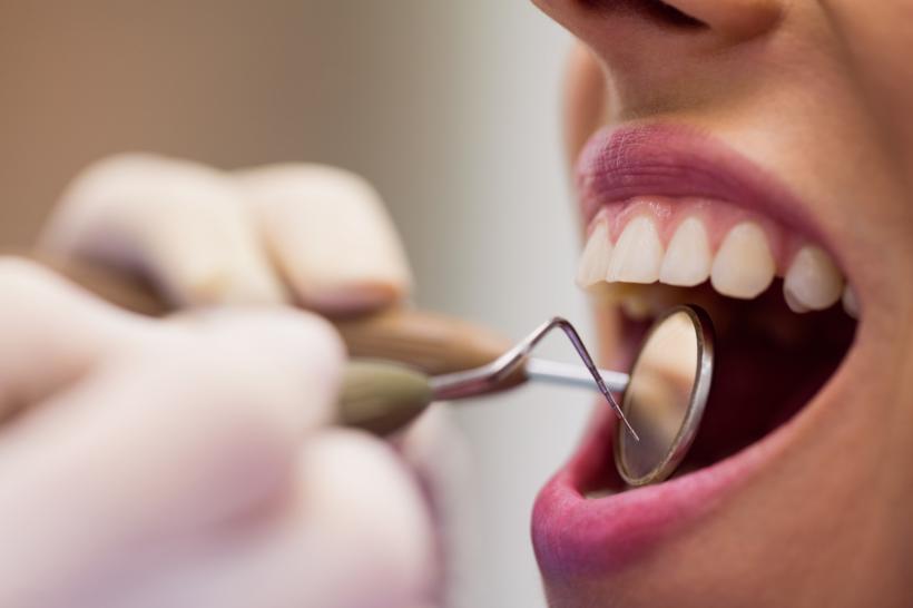 Cum poți preveni deteriorarea dinților. Sfaturi de la stomatologi