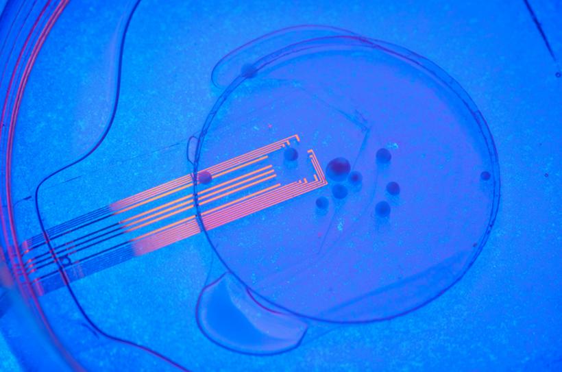 Inteligența artificială detectează cancerul pancreatic cu 18 luni înainte de diagnostic 18882775