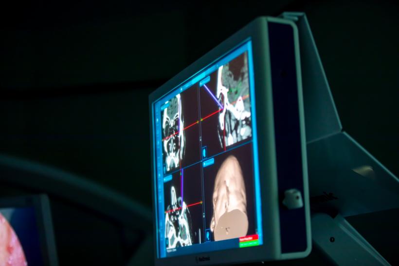 Premieră medicală în România. Operație pe creier prin pleoapă la Spitalul Militar „dr. Carol Davila” 18888710