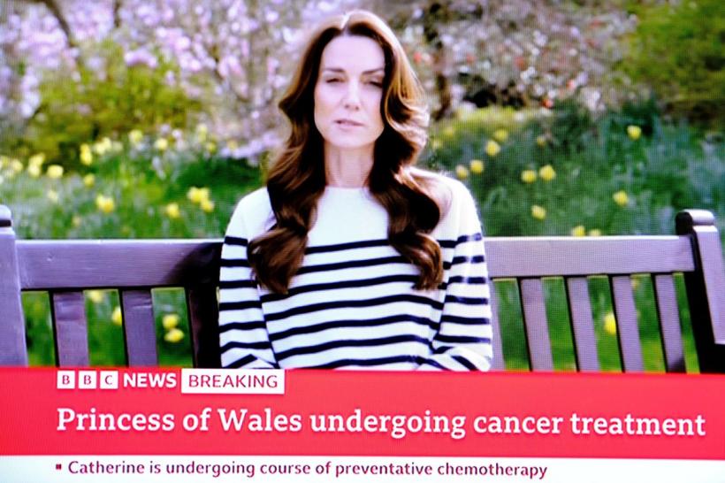 Oncolog explică ce este chimioterapia preventivă, după ce prințesa de Wales a anunțat că are cancer