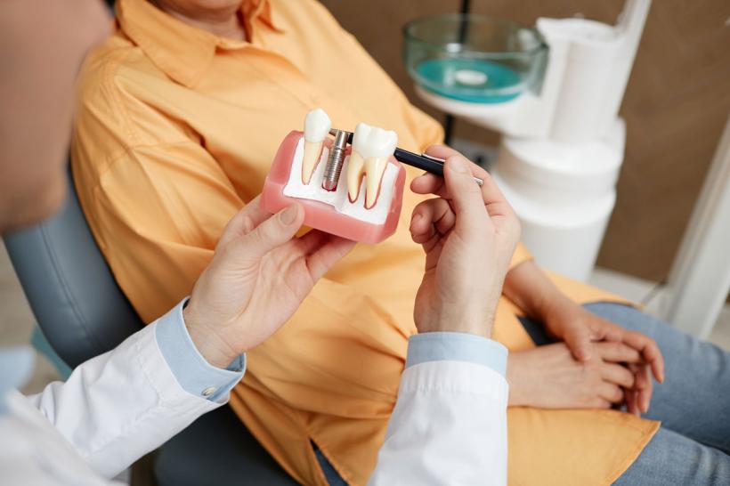 Garanția implantului dentar: Asumarea intervenției medicale