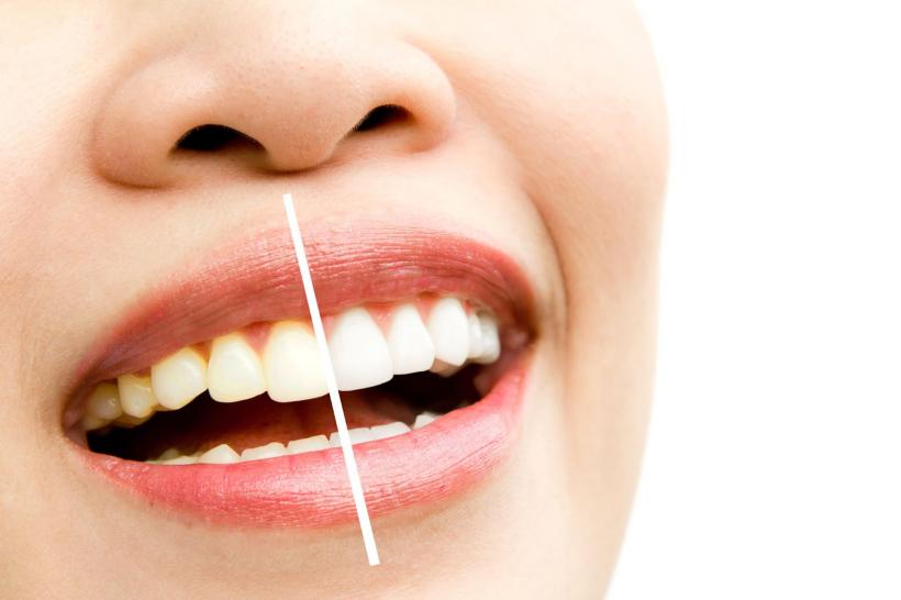 Fructul benefic pentru sănătatea dinților. Medic stomatolog: „Acţionează ca un înălbitor natural&quot;