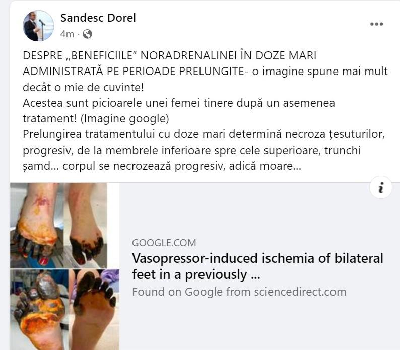 Scandalul Pantelimon, între Codul Penal și științele medicale. Procurorii acuză, doctorii ATI explică: Dozele-mamut de noradrenalină sunt toxice 18911663