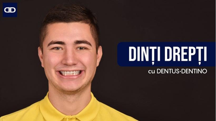 (P) Nu știi ce tip de aparat dentar ți se potrivește: invizibil, safir, metalic sau ceramic? La Dentus•Dentino, toate opțiunile sunt la îndemâna ta!