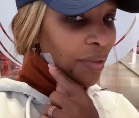 Serena Williams a fost operată de urgență. Campioana avea un chist uriaș pe gât 18922719