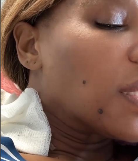 Serena Williams a fost operată de urgență. Campioana avea un chist uriaș pe gât 18922721